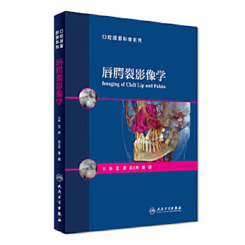 唇腭裂影像学