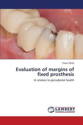 预订evaluation of margins of fixed prosthesis