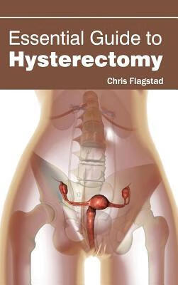 预订Essential Guide to Hysterectomy