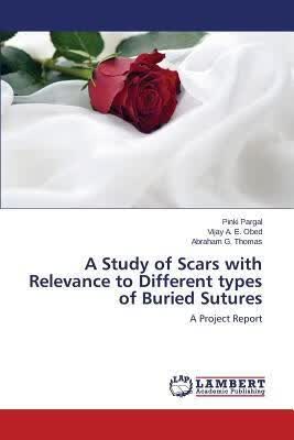 预订A Study of Scars with Relevance to Different Typ