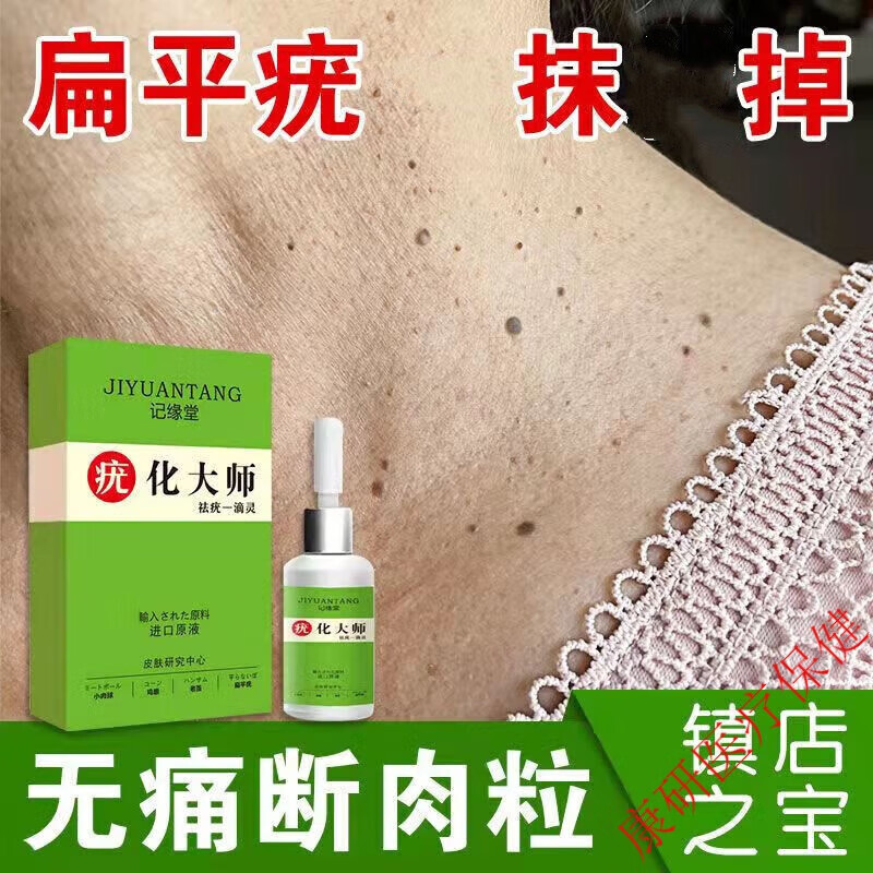 克疣液脚疣平常疣喷剂除丝状扁平疣颈部去1疣候子克优液脖子疣侯灵