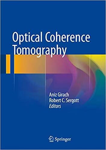 预订optical coherence tomography
