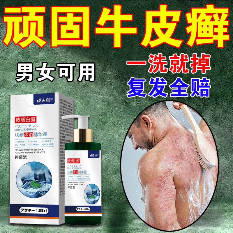 牛皮癣沐浴露 牛皮癣沐浴露进口干皮癣苗草王癣药浴泡澡包洗头水