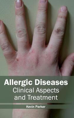 预订allergic diseases: clinical aspects and treatmen