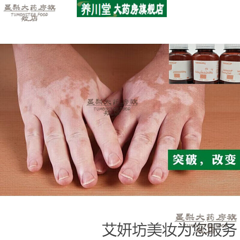 白之选复方补骨脂酊外用促黑色素生成白癜净修复液消白宁 50ml*1瓶