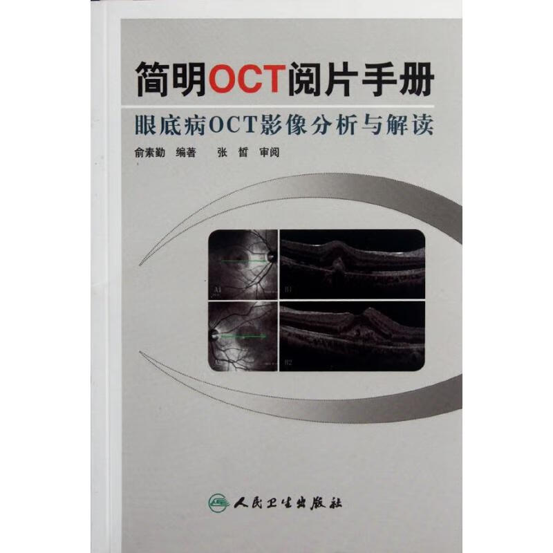 简明OCT阅片手册 俞素勤 书籍