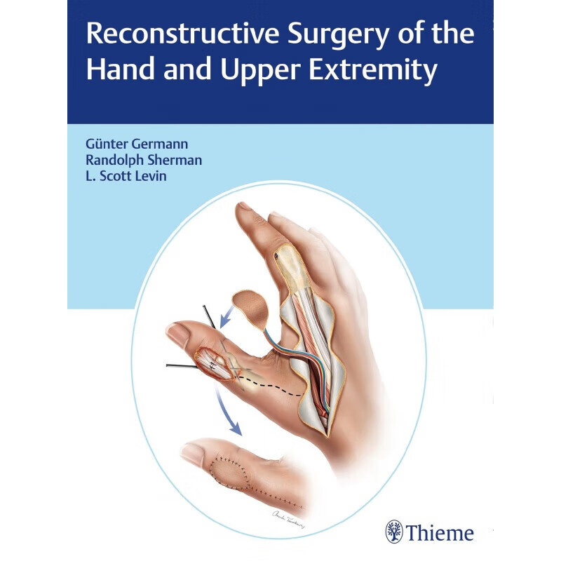 预定reconstructive surgery of the hand and upper extremity手和