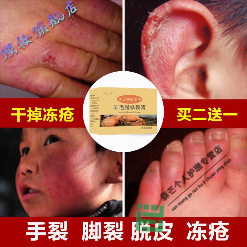 鸡皮肤也是老人手脚吗(四肢都是鸡皮肤怎么回事) 鸡皮肤也是老人手脚吗(四肢都是鸡皮肤怎么回事)