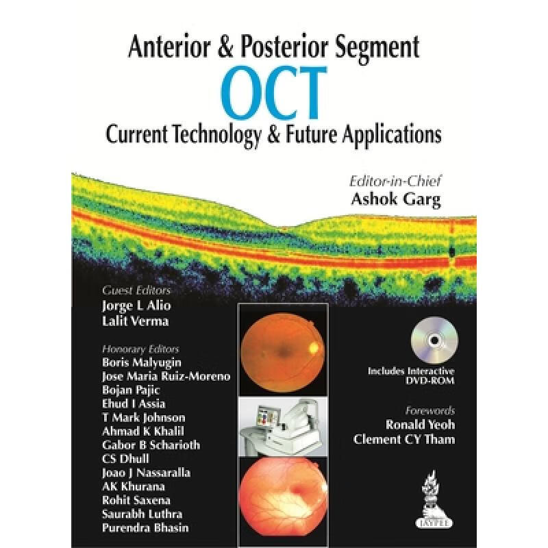 【4周达】anterior & posterior segment oct: current technology &