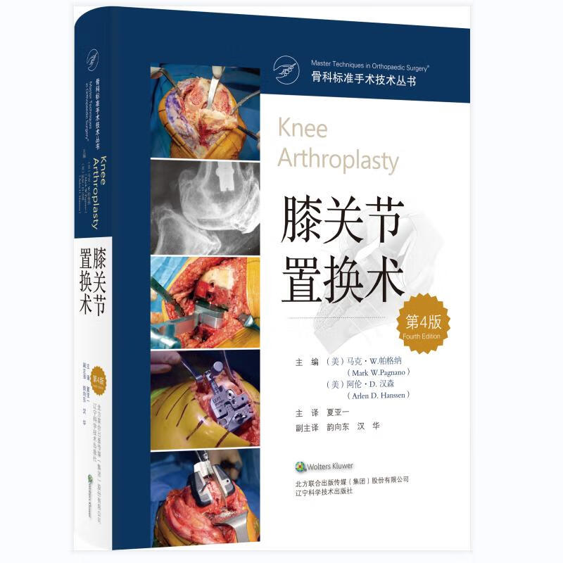 膝关节置换术(第4版)