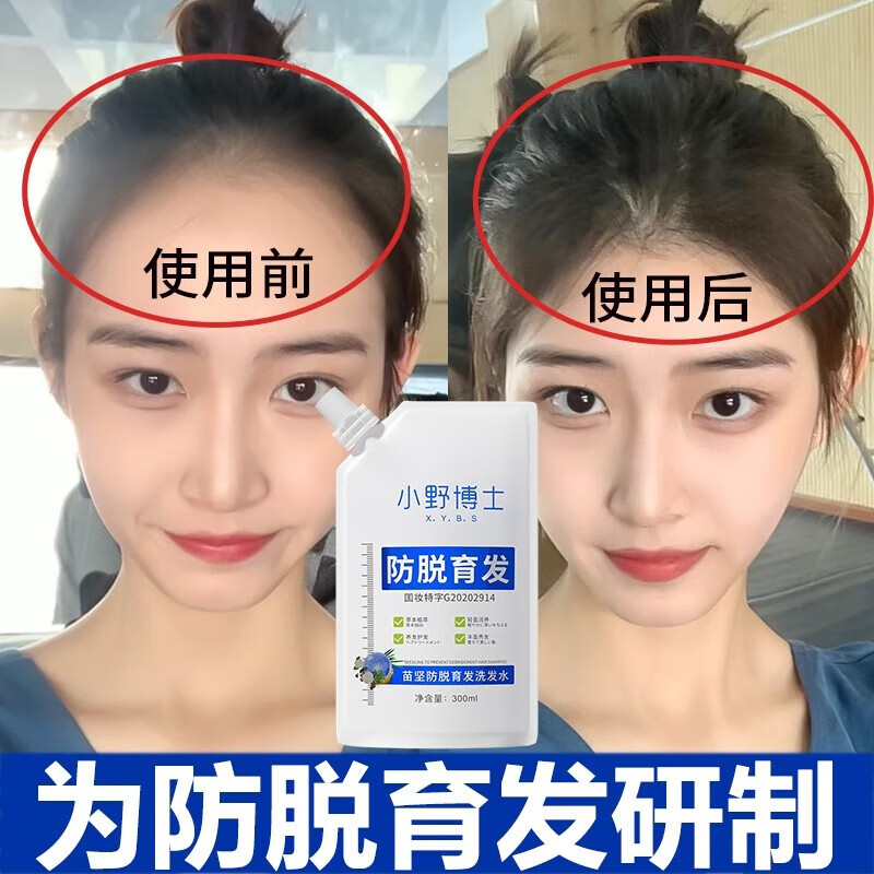 水生姜头发控油草本长发老姜王姜汁固发 单袋装【轻度掉发体验装】