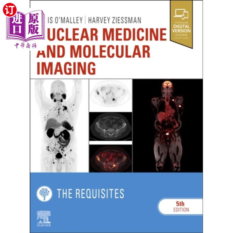 and molecular imaging: the requisites 核医学和分子成像:先决条件