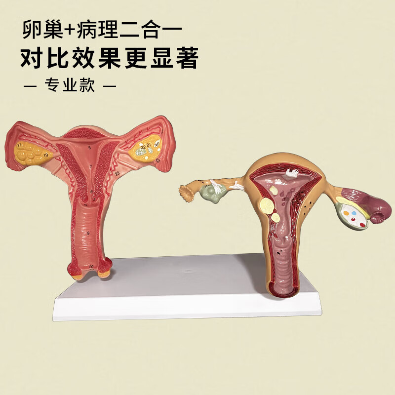 人体子宫附件模型女性医学生殖器卵巢病理病变结构解剖教学具 正常