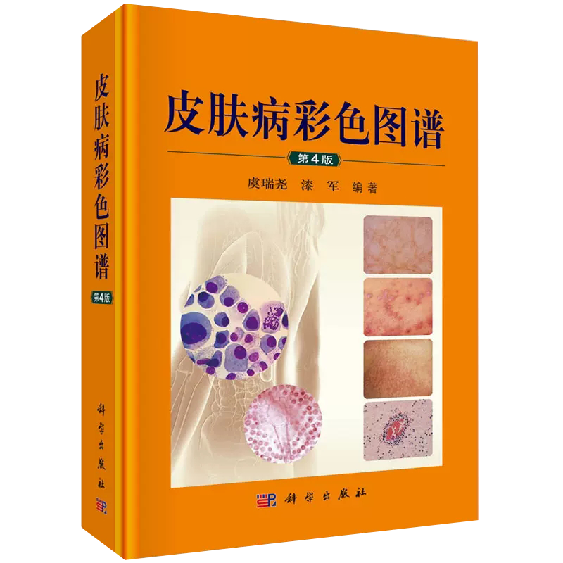 皮肤病彩色图谱皮肤病图谱彩图皮肤性病诊断图谱临床皮肤病学皮肤病