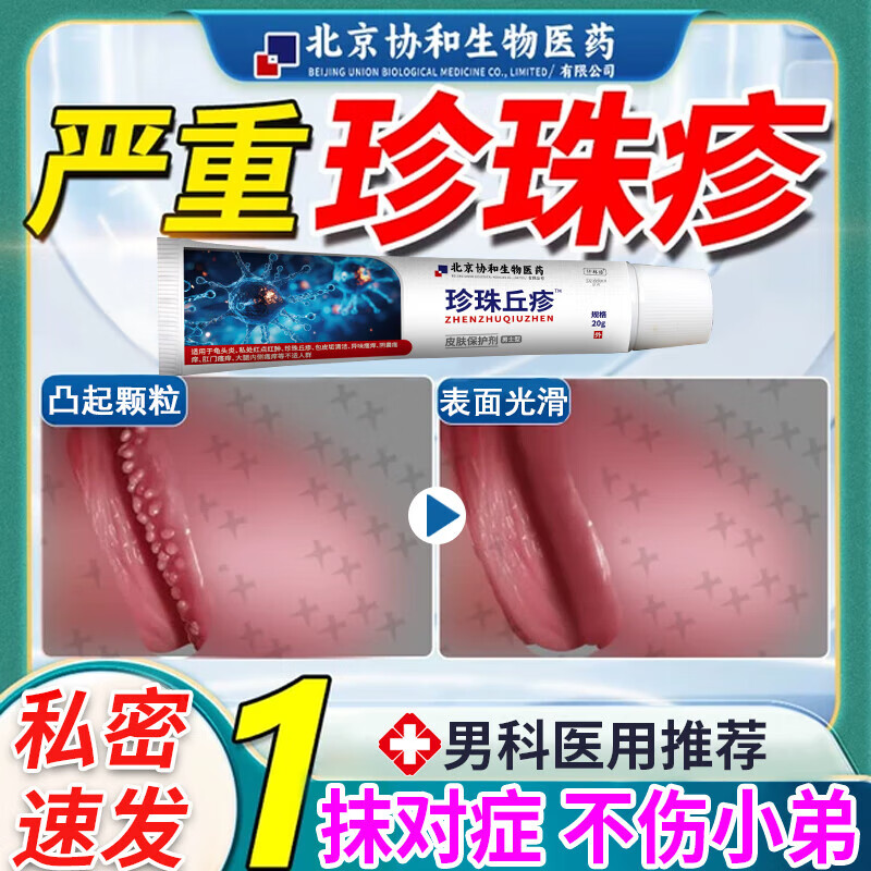 通用北京协和医院男性珍珠疹专用软膏i药品去除冠状沟珍珠疹私处瘙痒