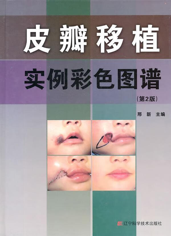 皮瓣移植实例彩色图谱（第2版） 邢新 医学 9787538168174