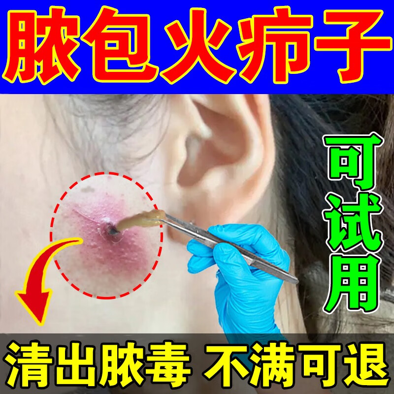 火疖子拔毒膏贴大包去脓包痘痘红肿硬块坐疮皮脂腺囊肿化脓排脓膏贴