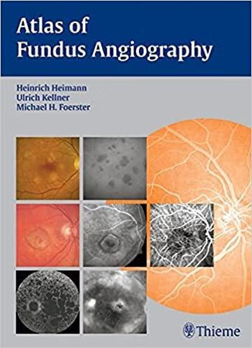预订atlas of fundus angiography