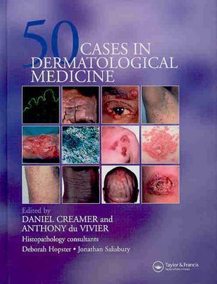 预订Fifty Dermatological Cases