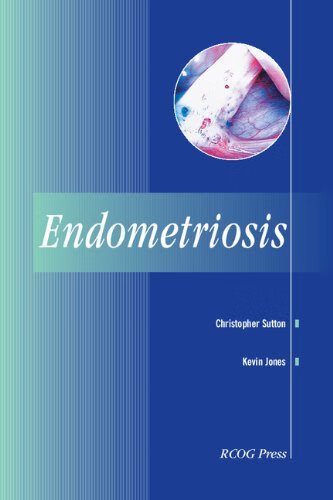预订 endometriosis