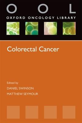 预订colorectal cancer