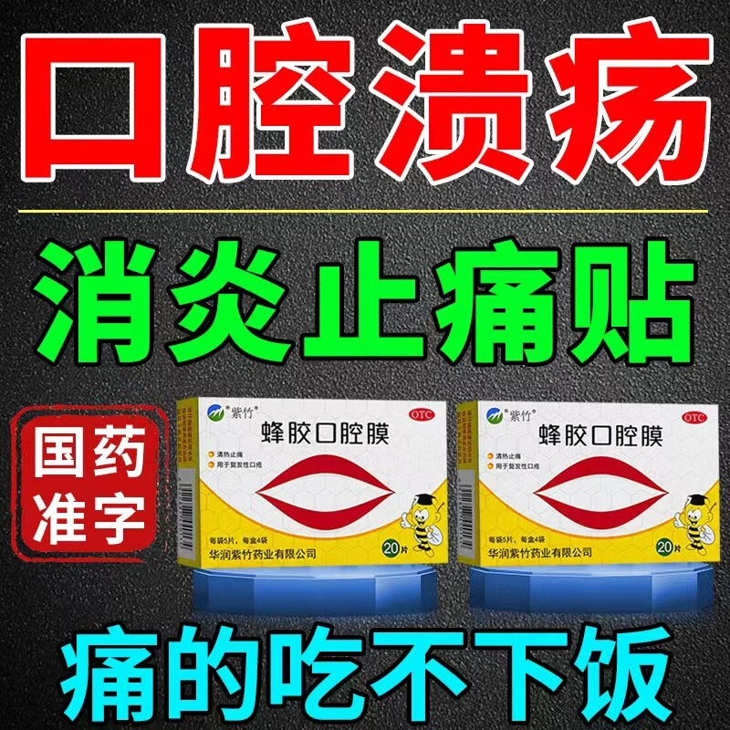 蜂胶口腔膜 治口腔溃疡的药口腔溃疡贴口舌生疮嘴巴里疼嘴巴起泡反复