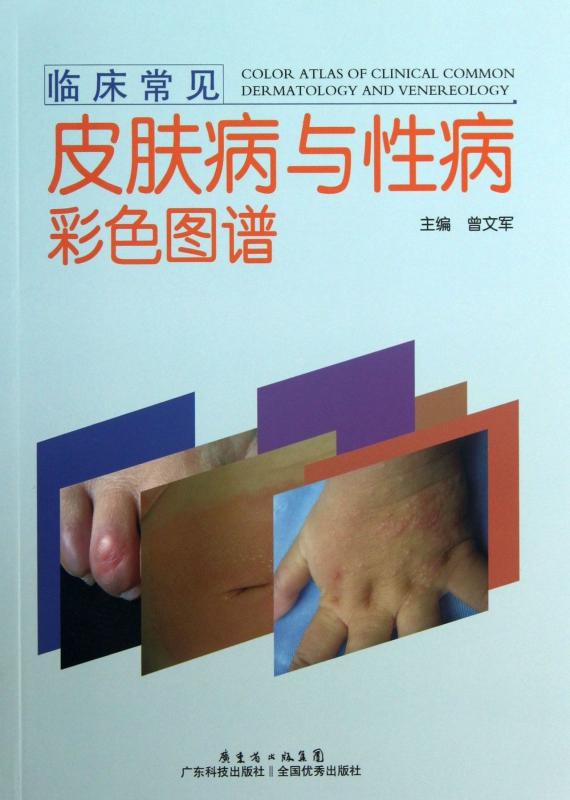 临床常见皮肤病与性病彩色图谱