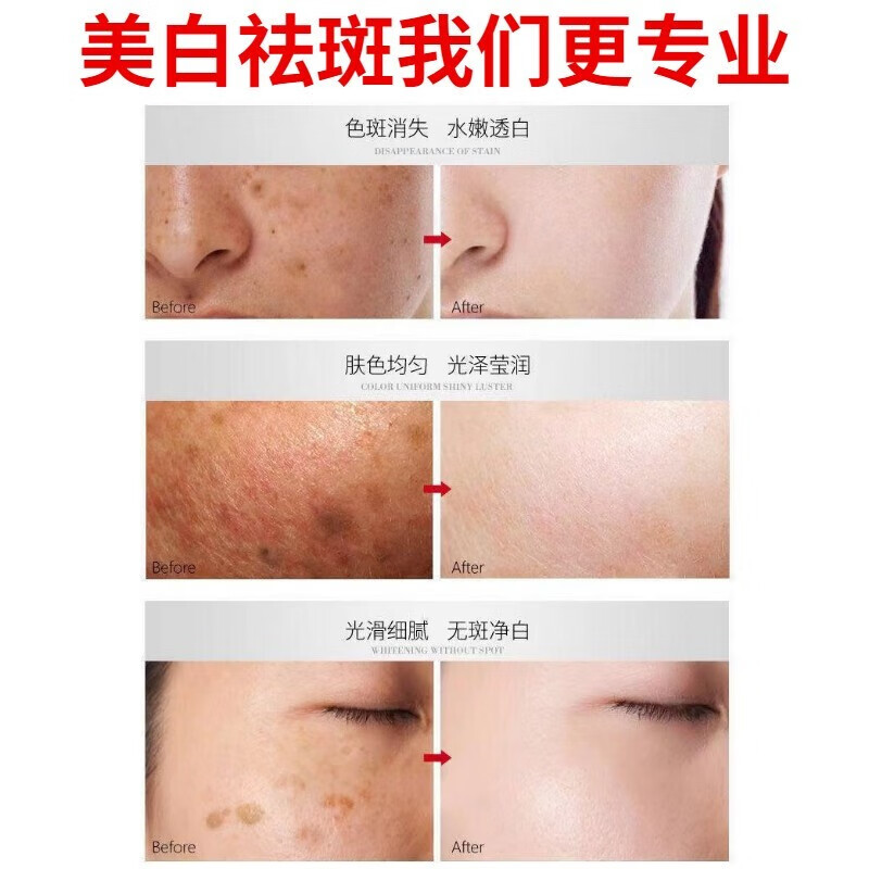 白云山星群美白祛斑洗面奶淡斑各种斑点黄暗提亮肤色深层清洁保湿洁面乳男女 1瓶装【推荐2瓶划算】