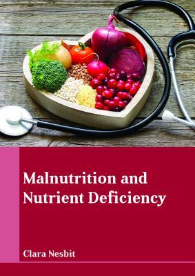 预订malnutrition and nutrient deficiency