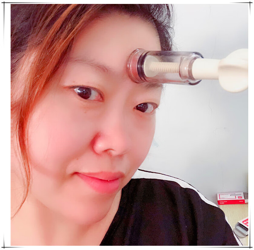 面部泄血罐放血罐脸部拔罐器拔青春痘粉刺吸罐手拧吸力大力度美容
