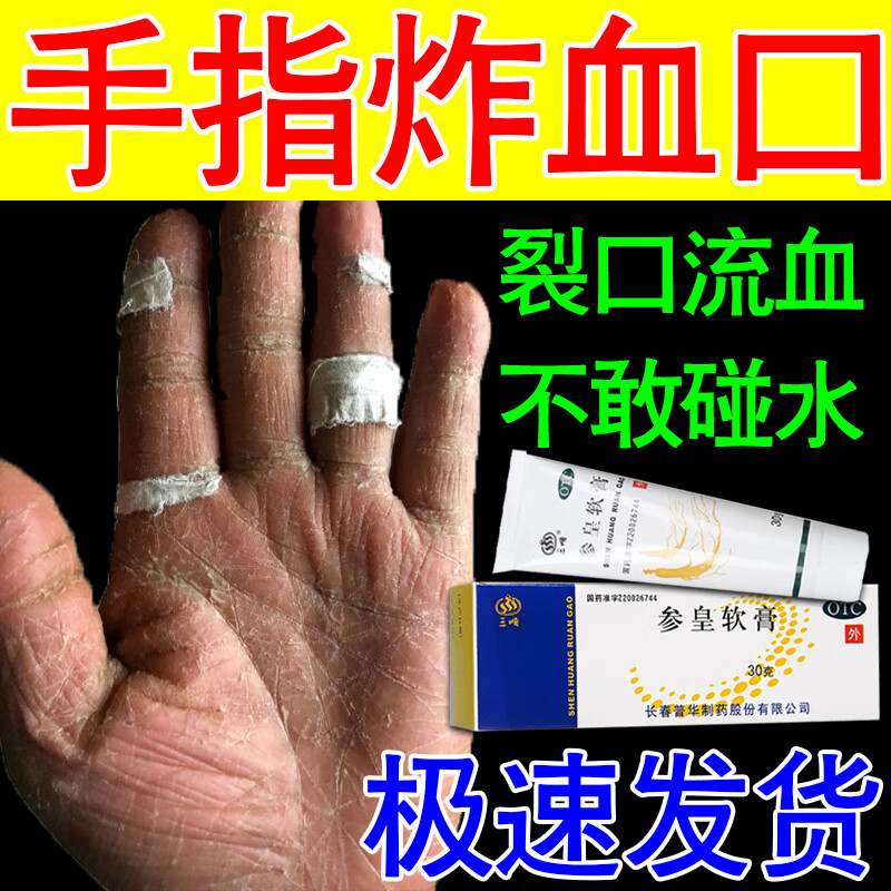 用于手掌手指干裂脱皮皮肤干燥药膏治手脚干裂干燥粗糙指甲缝手指头裂