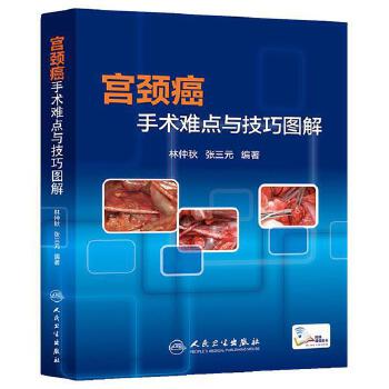 宫颈癌手术难点与技巧图解9787117189248