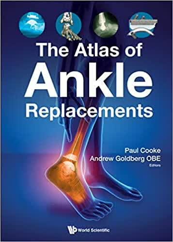 预订The Atlas of Ankle Replacements
