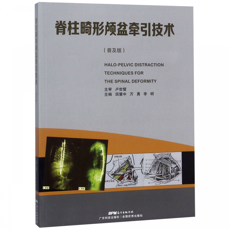 脊柱畸形颅盆牵引技术(普及版)
