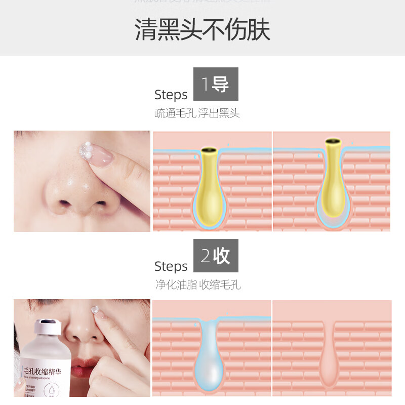fUT黑头导出液收缩毛孔精华去深层清洁粉刺闭口控油男女护肤品套装 去黑头收毛孔组合