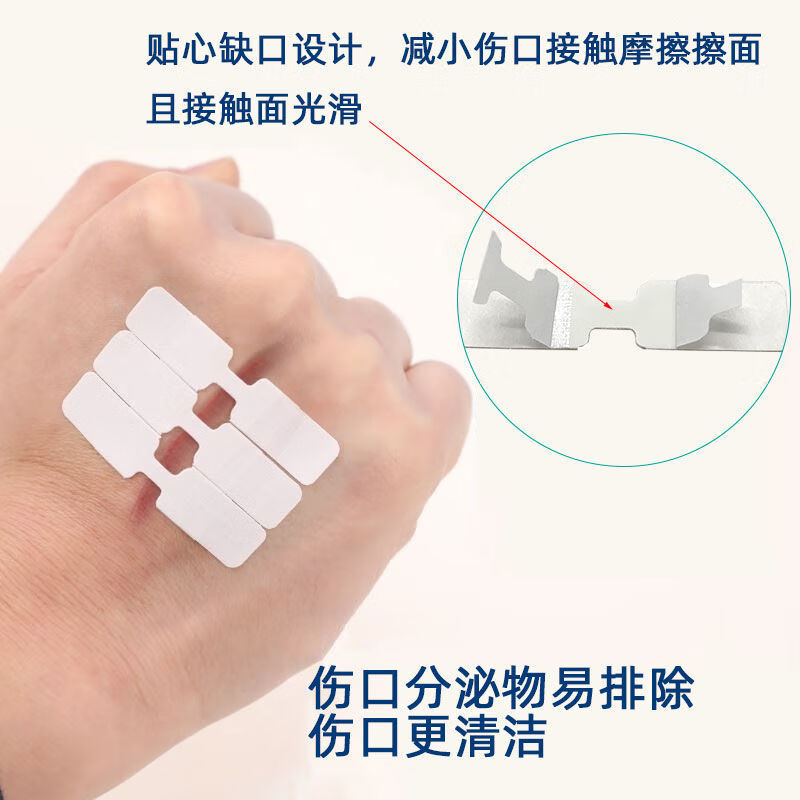 免缝胶带减张贴减张器伤口缝愈免缝胶布缝拉链式创 10片价格
