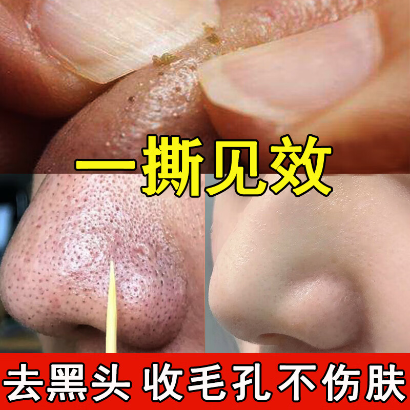 南京同仁堂撕拉面膜去黑头粉刺收缩毛孔黄金撕拉式深层清洁面膜80g/瓶