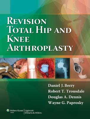 预订 revision total hip and knee arthroplasty