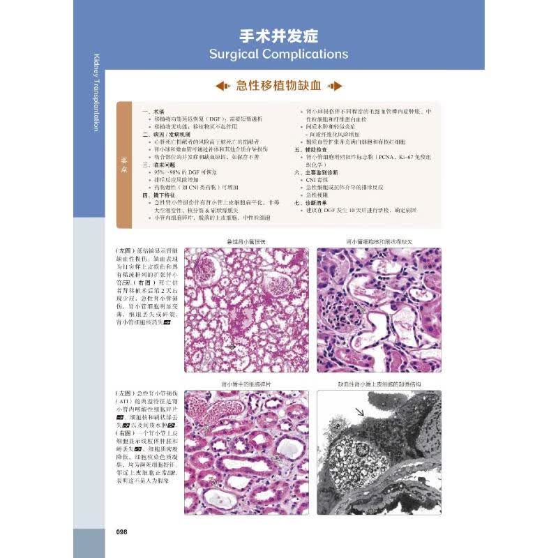 移植诊断病理学 原书第2版 图书