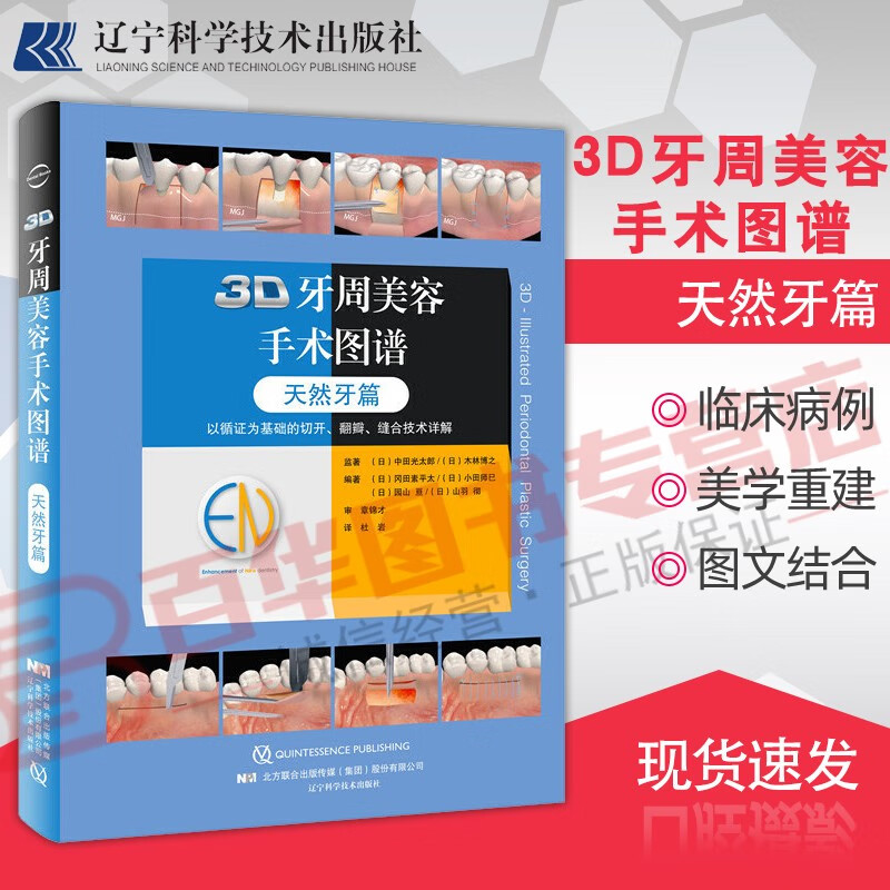 3D牙周美容手术图谱 天然牙篇中文翻译版 牙周手术方法集实用牙周整形手术口腔牙龈美容修复辽宁科学技术