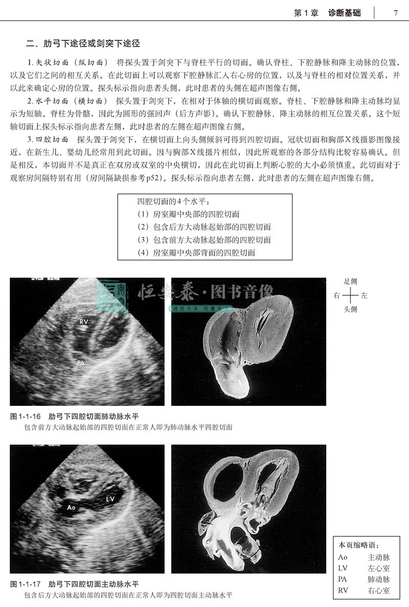 性心脏病超声精细讲解 里见元义日系经典·超声诊断精讲系列 切面解剖