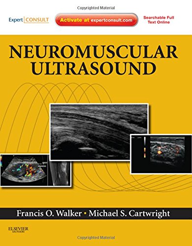 预订 neuromuscular ultrasound