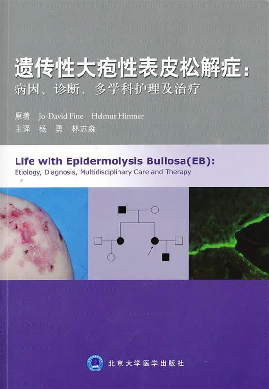 遗传性大疱性表皮松解症:病因,诊断,多学科护理及治疗