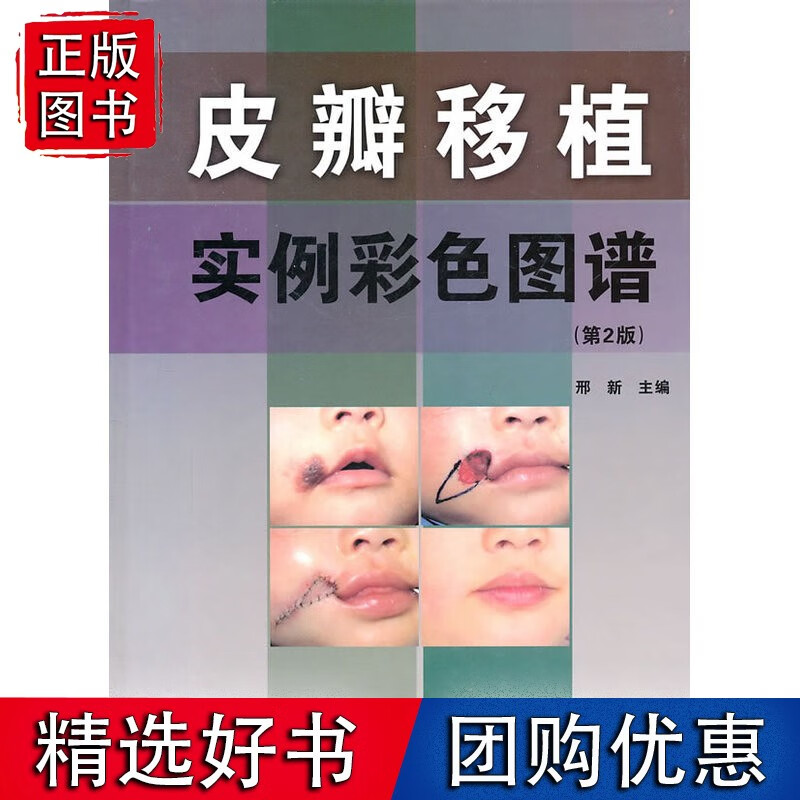 皮瓣移植实例彩色图谱（第2版）