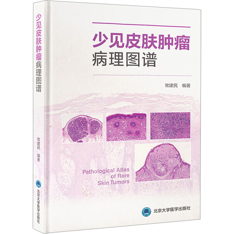 少见皮肤肿瘤病理图谱