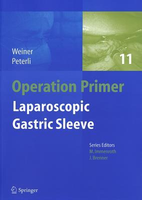 预订 laparoscopic sleeve gastrectomy
