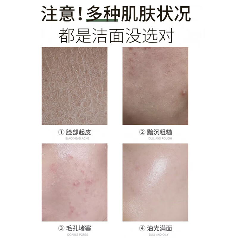 润凰叶绿素氨基酸洗面奶女深层清洁收缩毛孔去黑头控油祛痘细嫩洁面乳