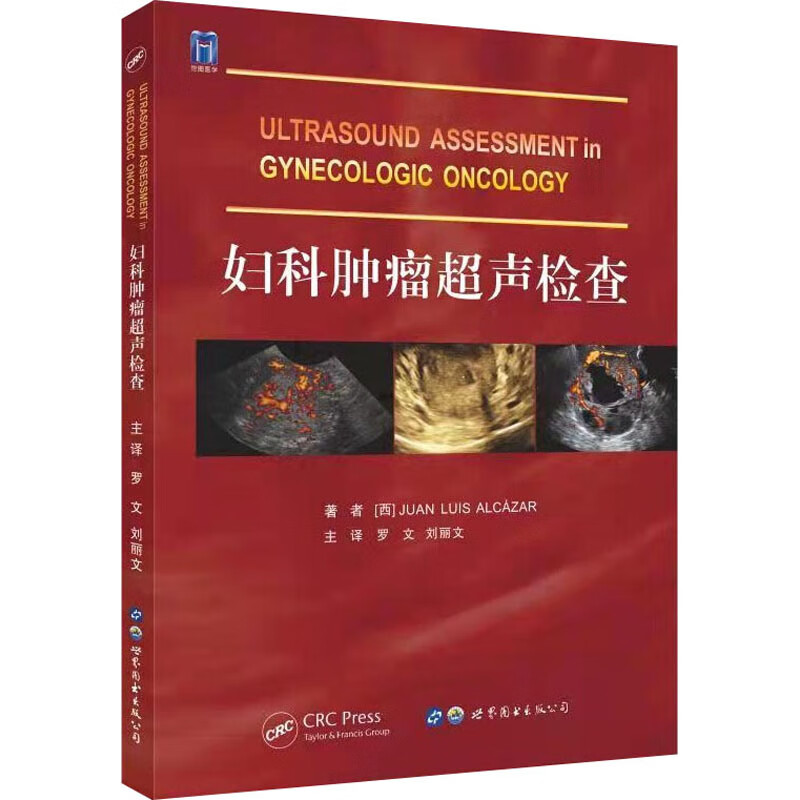 妇科肿瘤超声检查 图书