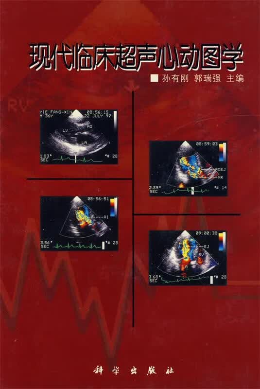 现代临床超声心动图学【正版好书,下单速发】