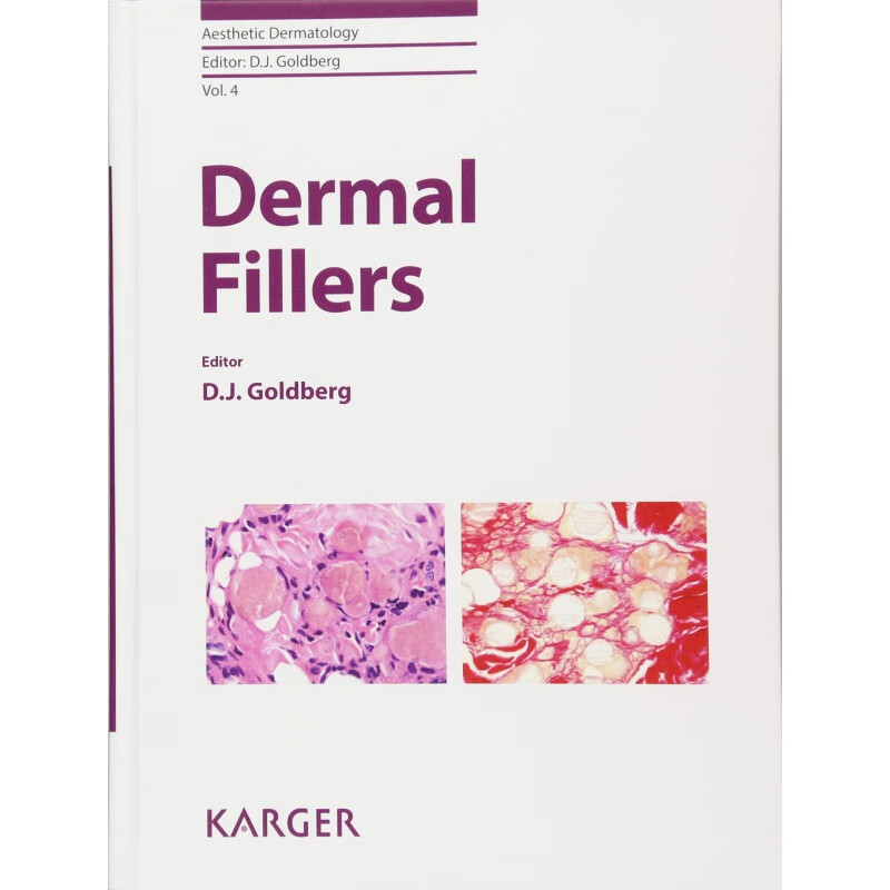 预定dermal fillers皮肤填充剂